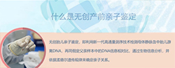 赤峰怀孕了需要怎么做亲子鉴定，赤峰产前做亲子鉴定办理流程